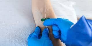 Exosome IV Infusion Therapy